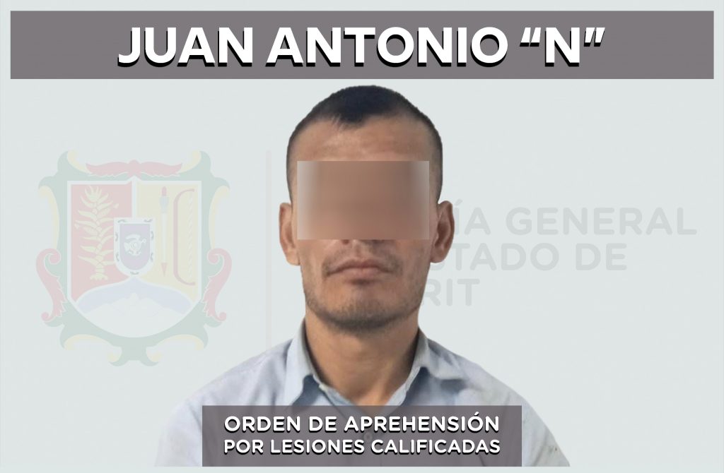 APREHENDIDO PROBABLE RESPONSABLE DE LESIONES CALIFICADAS